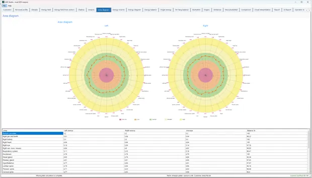 GDV Studio – Area diagram