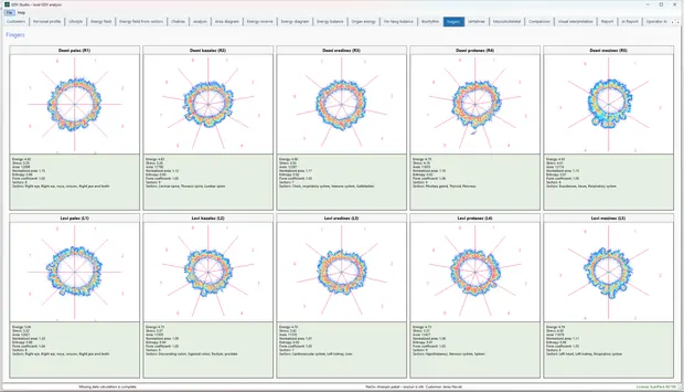 GDV Studio – Ten-finger analysis