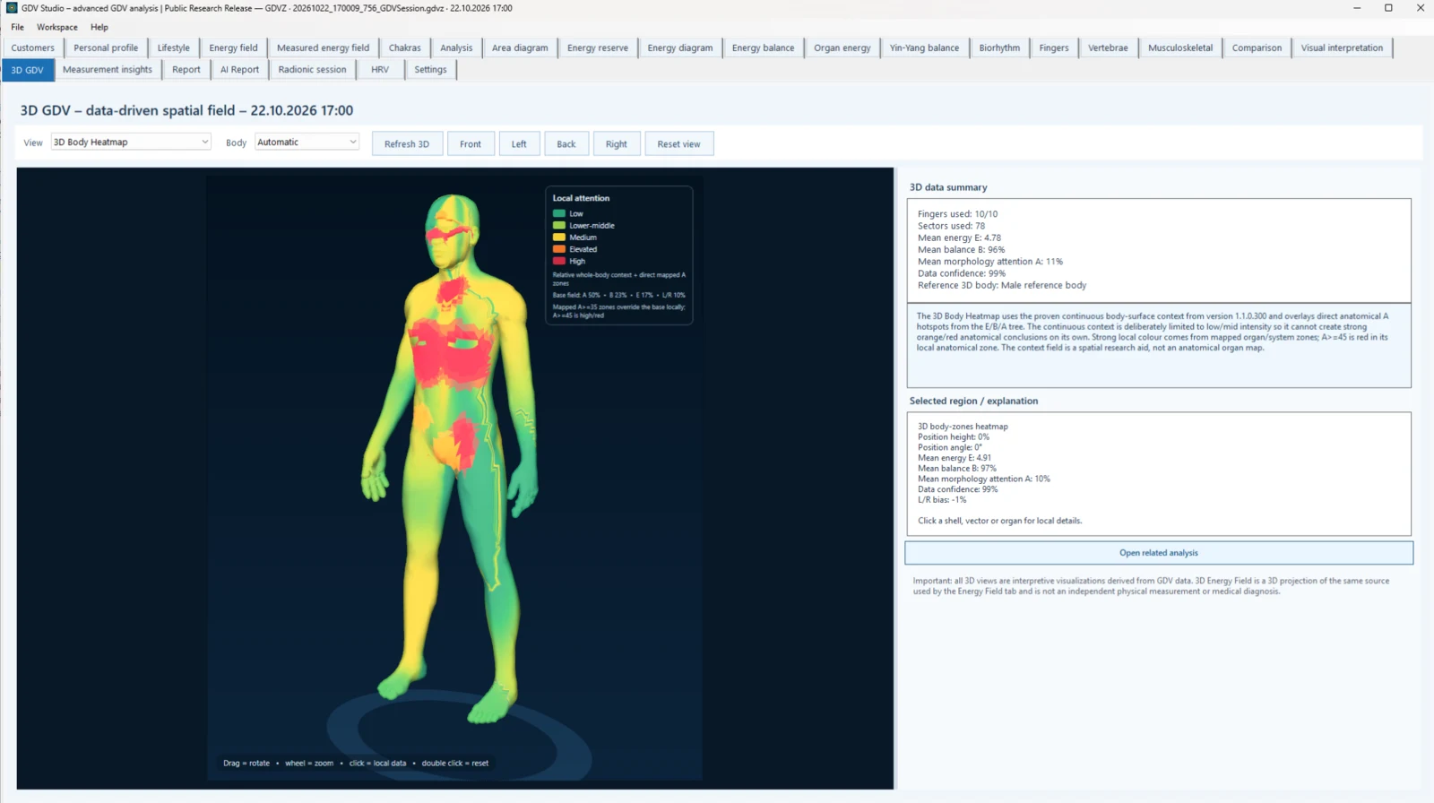 GDV Studio 3D Body Heatmap view